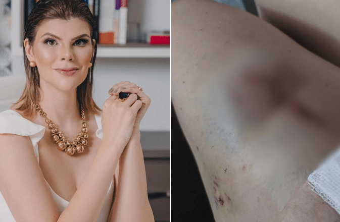 Médica do Paraná se torna ré por dar falsos diagnósticos de câncer de pele e recomendar cirurgias desnecessárias